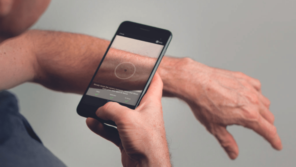 prevenzione digitale melanoma